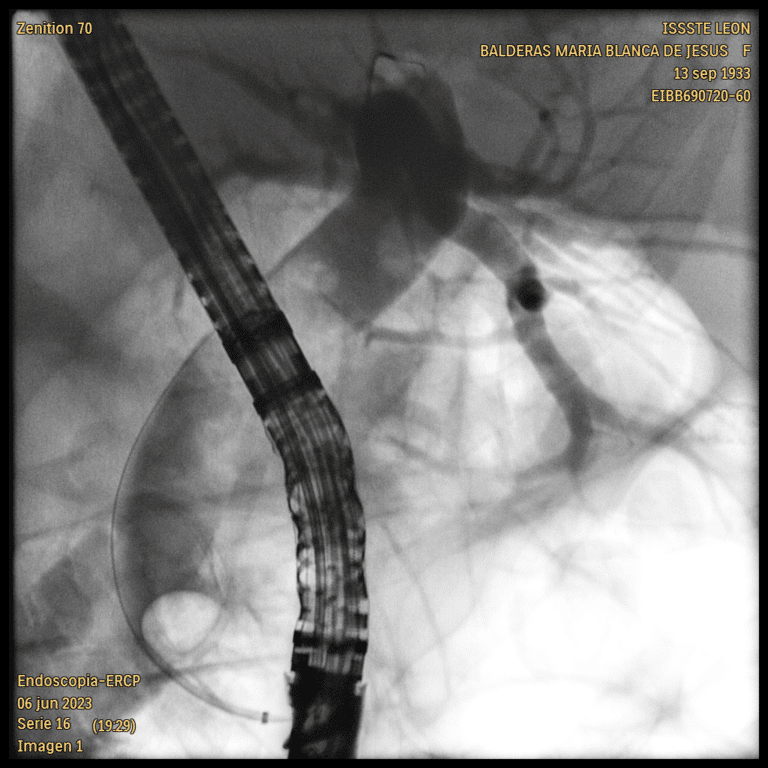 cpre cerca de Querétaro